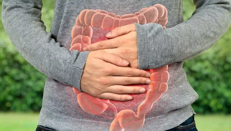 Gençlerde Kolon Kanseri Alarmı: Doktor 4 Erken Belirtiyi Açıkladı